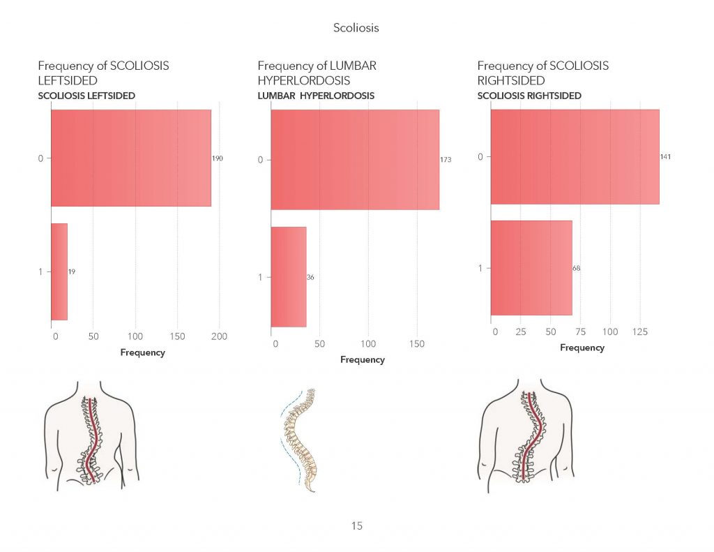 Stages Of Scoliosis