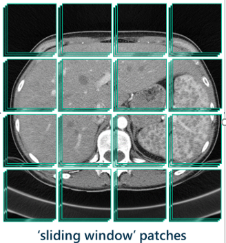 Liver CT scan divided into 16 blocks for analysis