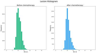 Figure 5. Histograms of the same lesion before and after chemotherapy